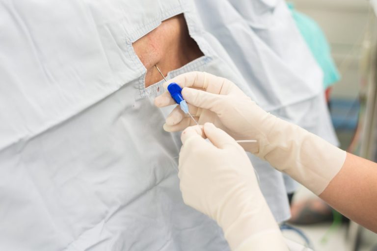 10 Info Bius Epidural Anda Perlu Tahu Semasa Pembedahan Caeserean