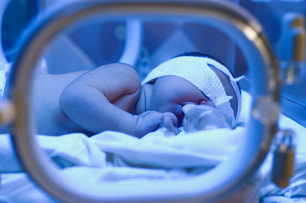 3 Hari Lahir Anak Demam Kuning Normal Jururawat Kongsikan Bacaannya