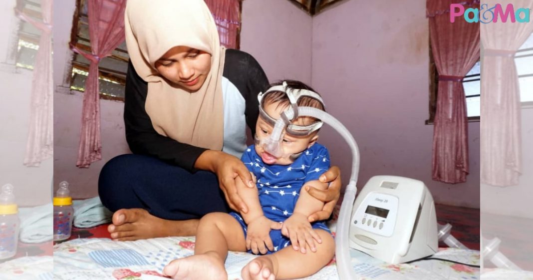 Bukan Mudah Terima Kenyataan. Ibu Positif Anak Derita 3 Penyakit Akan