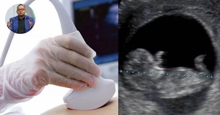 Due Date Lebih Dari Satu. Mana Yang Nak Ikut. Doktor Berikan Penjelasan