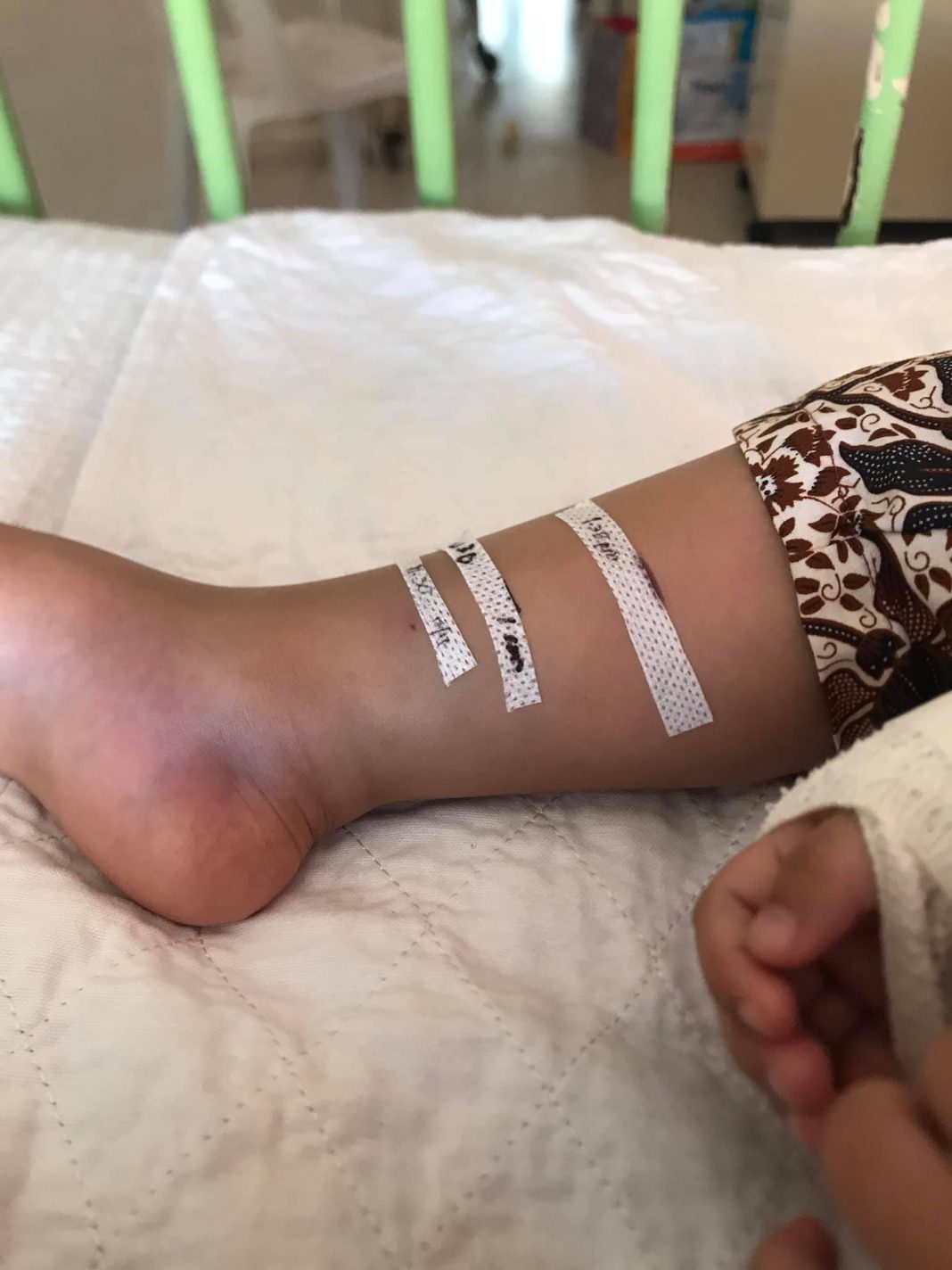Anak Mengadu Sakit Kaki, Dipatuk Ular Berlingkar Di Rantai Basikal