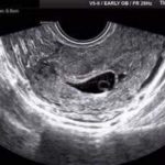 Copy of NEWBORN – 2021-08-31T221538.424