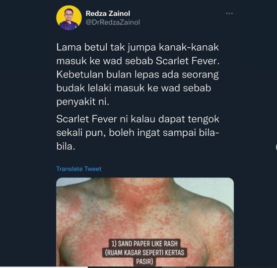 Anak Asyik Bergaru, Awasi Ruam Kasar Luar Biasa, Mungkin Dijangkiti 'Scarlet Fever'! 7 Anak Asyik Bergaru, Awasi Ruam Kasar Luar Biasa, Mungkin Dijangkiti ‘Scarlet Fever’!