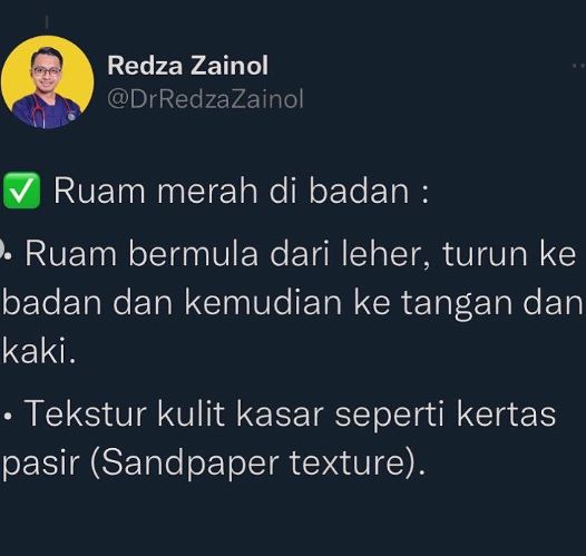 Anak Asyik Bergaru, Awasi Ruam Kasar Luar Biasa, Mungkin Dijangkiti 'Scarlet Fever'! 10 Anak Asyik Bergaru, Awasi Ruam Kasar Luar Biasa, Mungkin Dijangkiti ‘Scarlet Fever’!