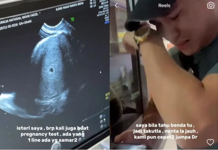 Isteri Atiq Azman Hamil Anak Sulung, Bimbang Kandungan Luar Rahim