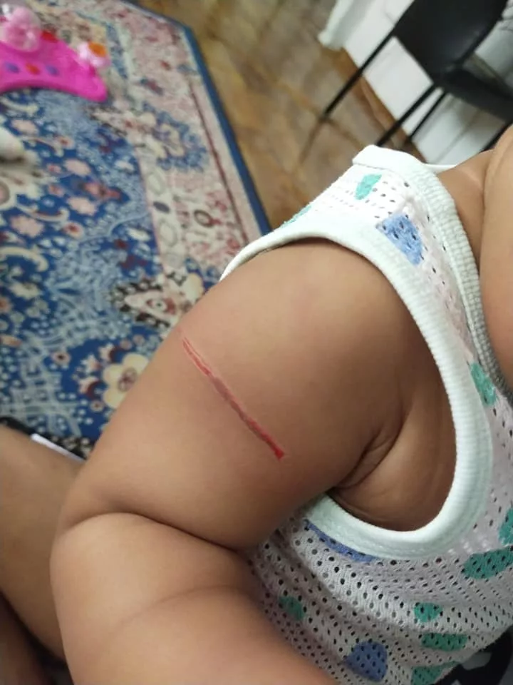 ‘Panjang Lukanya…’ Bahu Anak Tertoreh, Ibu Tak Sangka Sofa Mewah Undang Bahaya