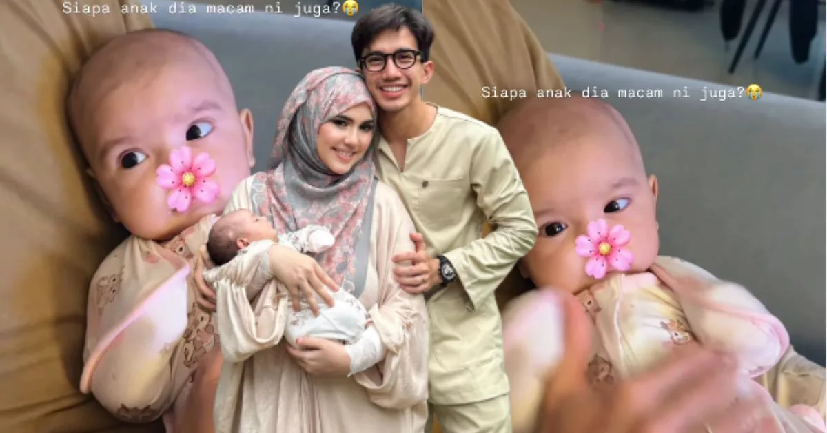 ‘Siapa Anak Dia Macam Ini…’ – Dahlia Risau Mata Baby Yusra Juling, Ramai Pernah Alami
