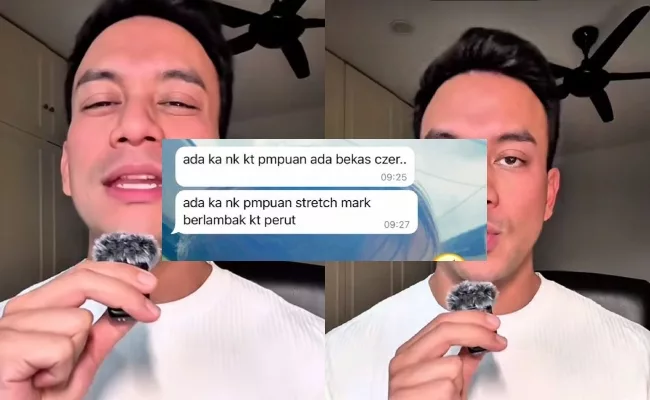‘Stretch Marks & Parut Caesar Bukan Kecacatan, Tapi Lambang Kekuatan Ibu’ – Dr Say