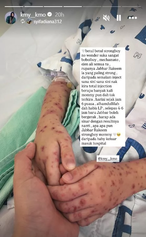 “Perkasalah Wahai Jabbar.” Kmy Kmo Mohon Doa Result Sampel Air Tulang Belakang Anak Negatif Jangkitan Kuman