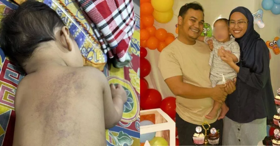 Badan Anak Penuh Lebam Balik Pusat Jagaan, Ibu Kecewa Kes Ditutup