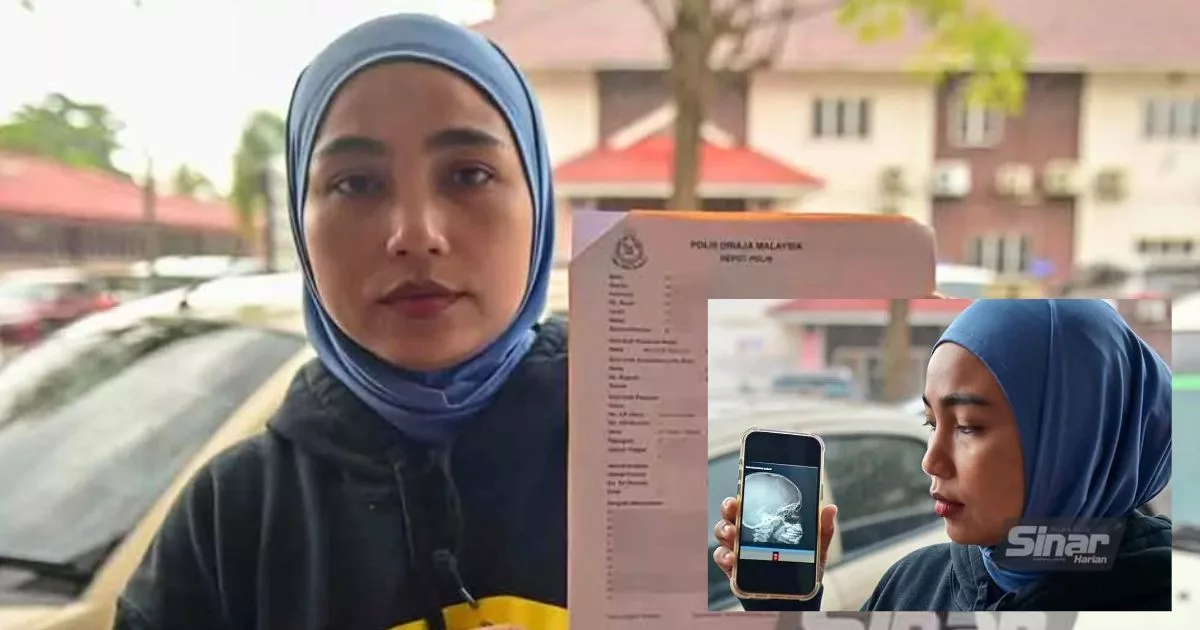 Lagi Kes Buli! Murid Tahun 2 Patah Hidung, Mengadu Dikepung & Ditendang Di Sekolah!