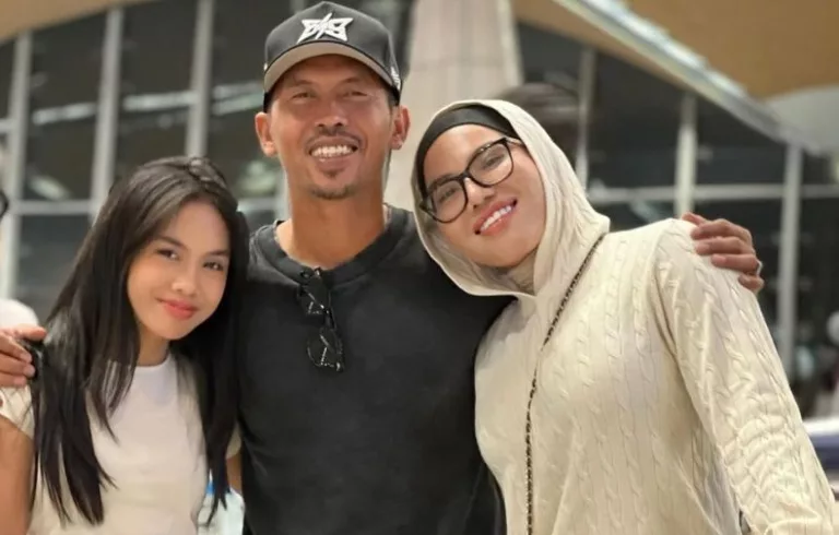 Talita Melecur Teruk Terkena Minyak Panas, Muka & Tangan Paling Teruk!