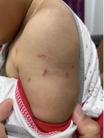 “Hati Ibu Mana Yang Tahan… ” Badan Anak Penuh Luka Cengkaman Kuku, Pengasuh Gen Z Pula Nafi