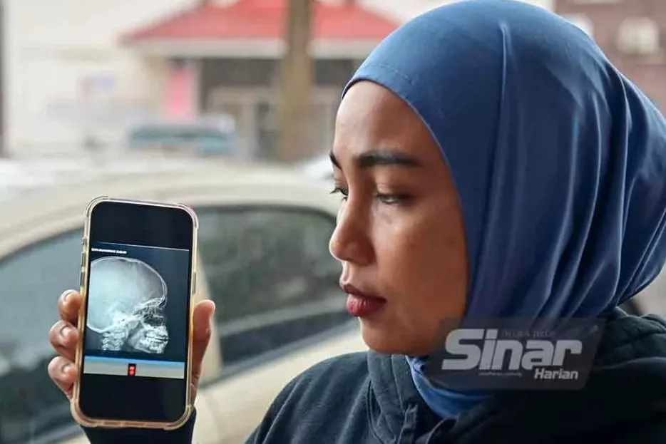 Lagi Kes Buli! Murid Tahun 2 Patah Hidung, Mengadu Dikepung & Ditendang Di Sekolah!