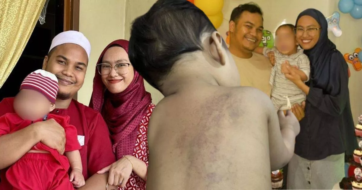 Badan Anak Penuh Lebam Balik Pusat Jagaan, Ibu Kecewa Kes Ditutup