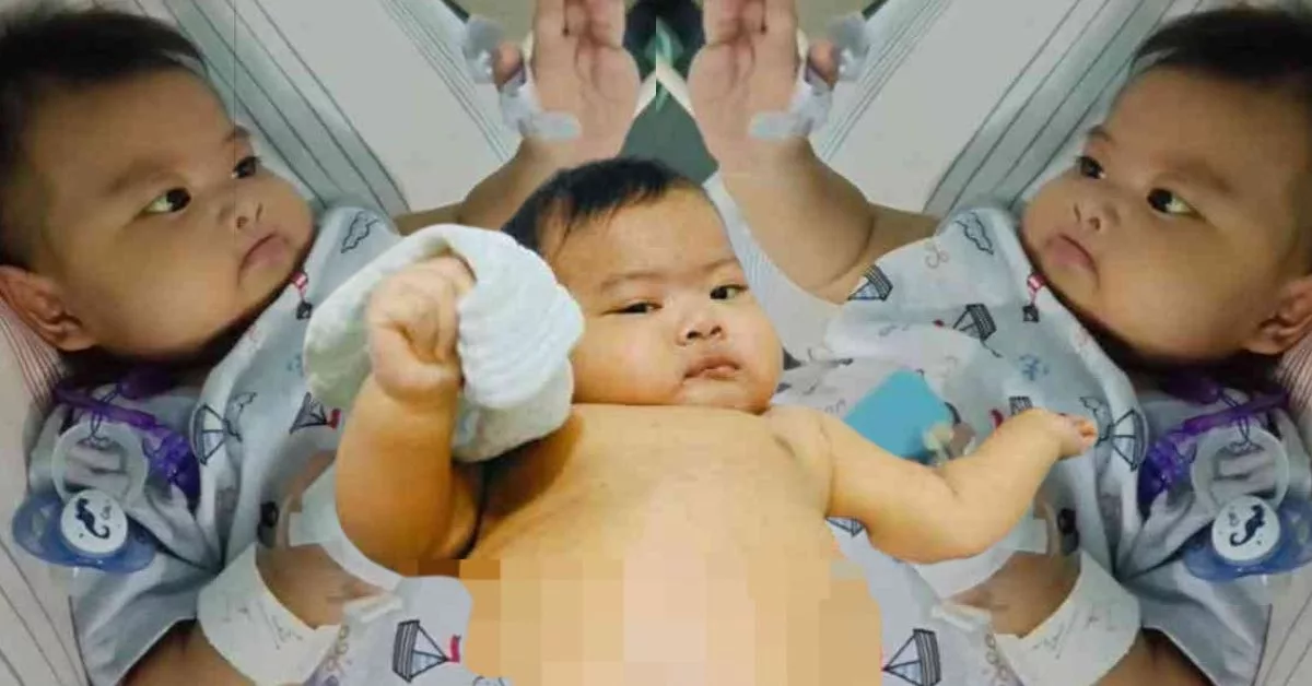 Derita Biliary Atresia, Bayi 7 Bulan Umair Musa Perlukan RM100,000 Lagi Untuk Pembedahan Hati