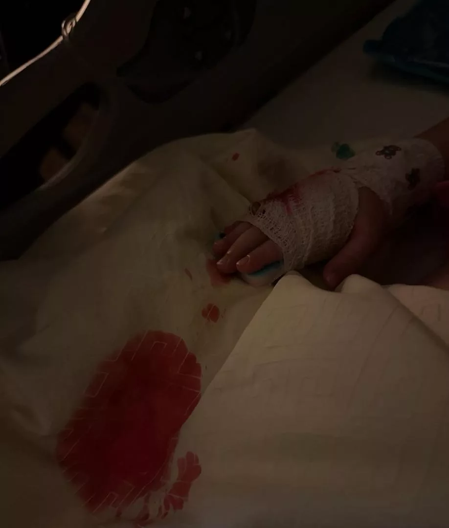 “Doakan Nayla Cepat Baik…” Ayda Jebat Sedih Lihat Kulit Anak