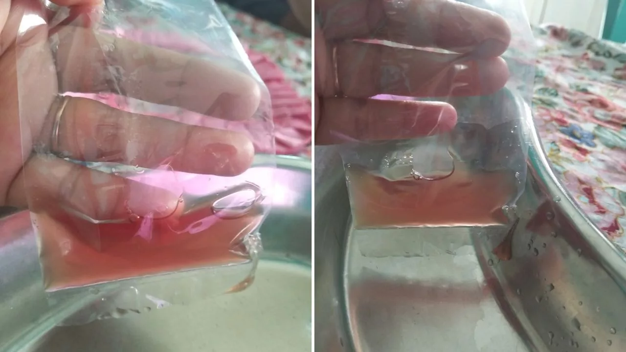 Ibu Sebak, Anak 4 Tahun Kencing Berdarah Lepas Minum & Makanan Berwarna