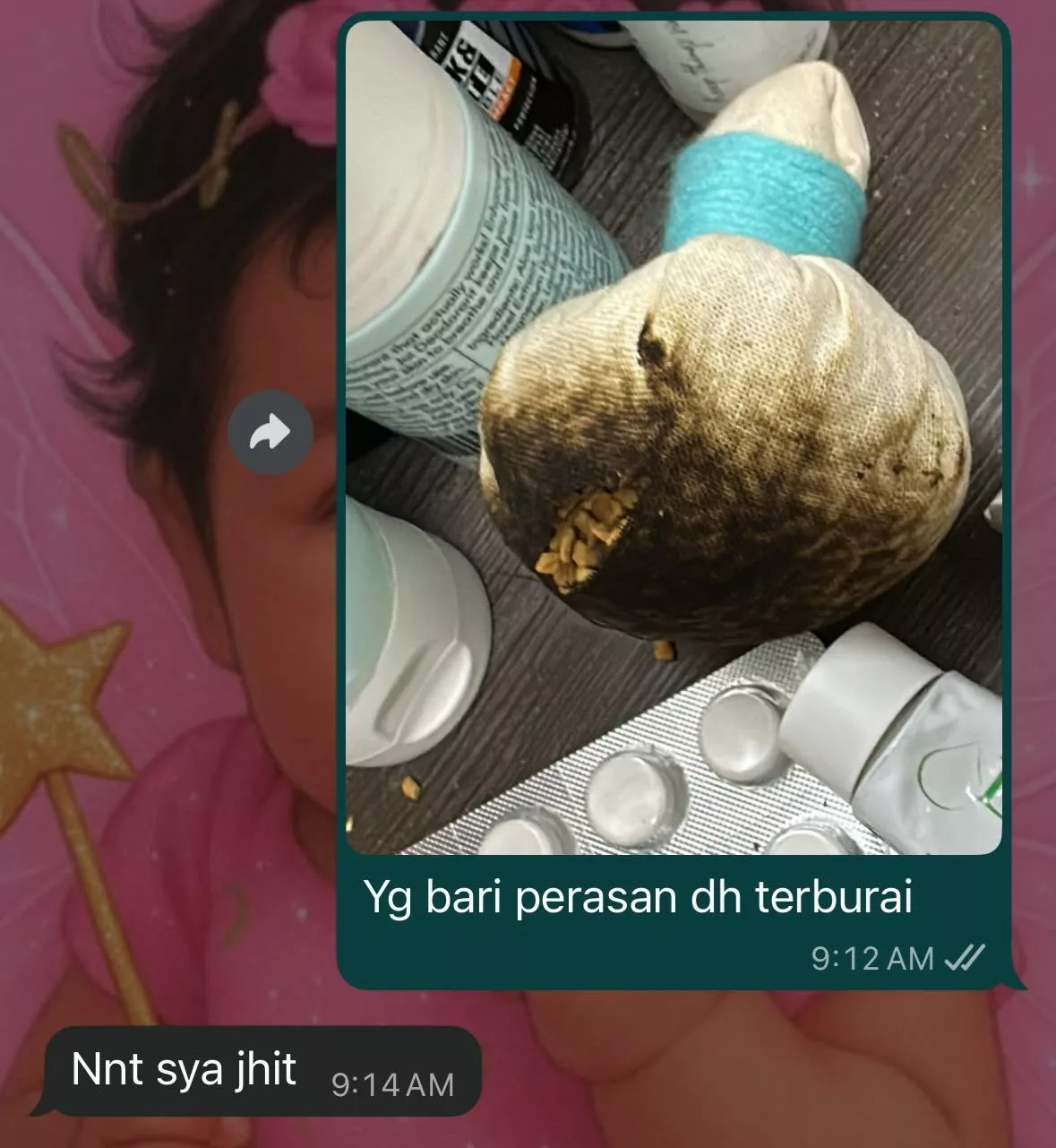 CL Dari Neraka! Ibu Berpantang Trauma Kaki Melecur, Duit Habis RM2,000