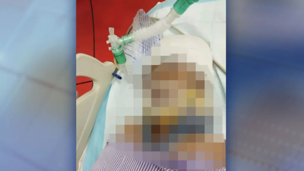 “Tolonglah Doakan Anak Sulung Saya…” Pilu Luahan Bapa Kanak-Kanak 7 Tahun Dipukul Tukul