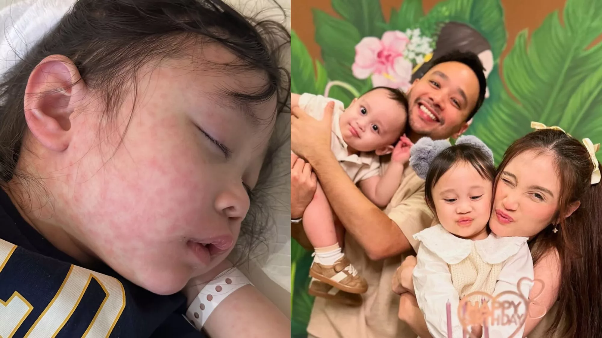 “Doakan Nayla Cepat Baik…” Ayda Jebat Sedih Lihat Kulit Anak