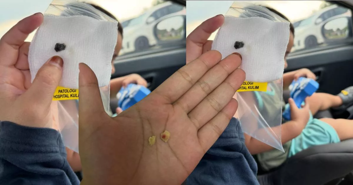 Ibu Cemas Span Mekap Termasuk Dalam Hidung Anak, Rungkai ‘Misteri’ Bau Busuk