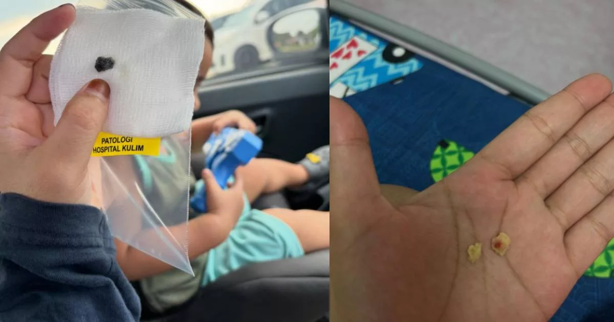 Ibu Cemas Span Mekap Termasuk Dalam Hidung Anak, Rungkai ‘Misteri’ Bau Busuk