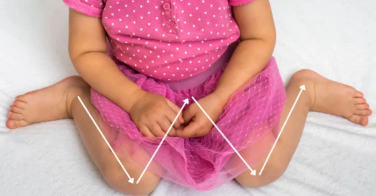 Pantau Cara Anak Duduk, Postur Kaki ‘W-Sitting’ Undang Risiko Badan Tak Seimbang