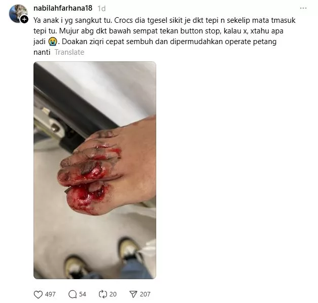 “Kasihan Adik Ni, Kaki Tersepit Di Eskalator.” Elvina Mohamad Jadi Saksi Kejadian Cemas, Tititp Pesanan Buat Ibu Ayah