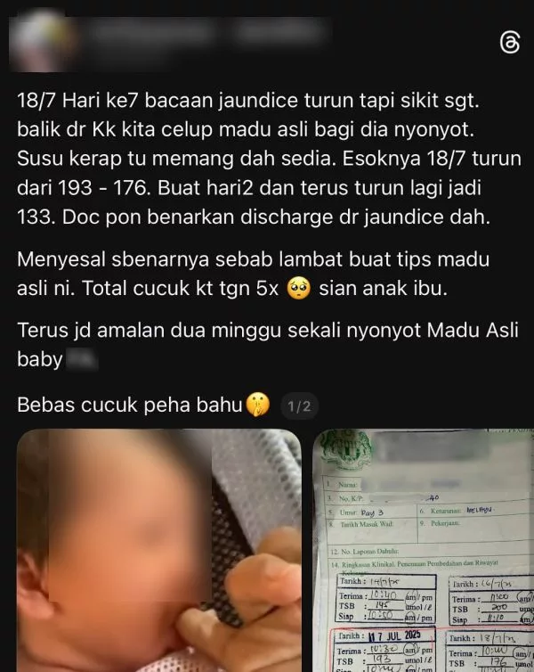 Bahaya Madu Kepada Bayi, Pakar Jelaskan Risiko Botulisme Yang Boleh Meragut Nyawa