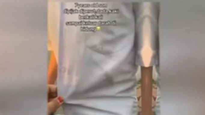 Murid Tahun Satu Dibuli Hingga Masuk Hospital, Ibu Bapa Rayu Tindakan Tegas