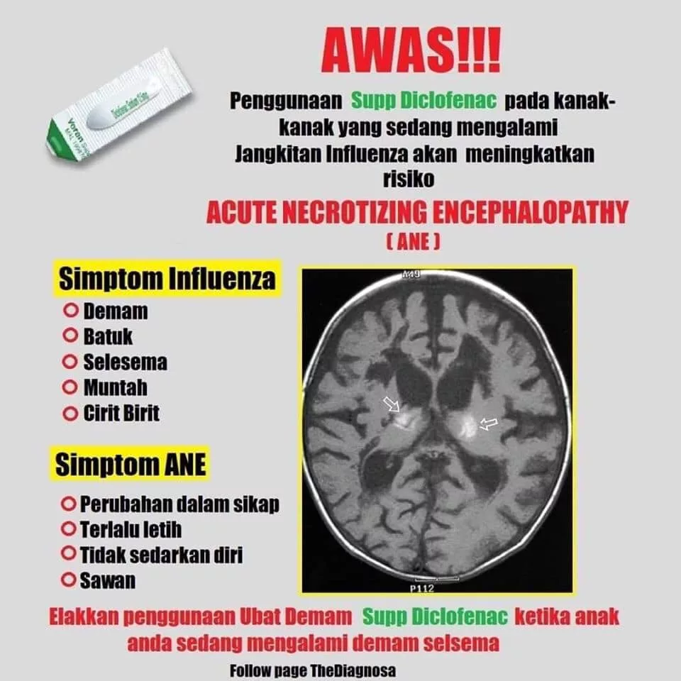 Supp Voren & Influenza B, Kisah Tragis Anak Brain Dead Kembali Tular 7 Supp Voren & Influenza B, Kisah Tragis Anak Brain Dead Kembali Tular