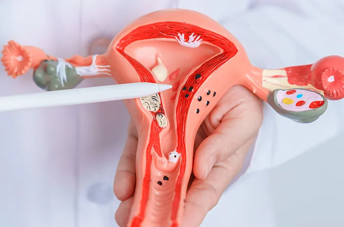 Diuji dengan PCOS, Masihkah Ada Peluang Menjadi Ibu?