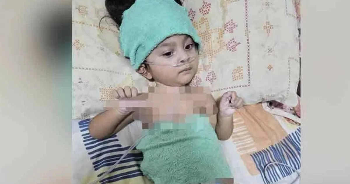 “Tolong Selamatkan Nadine” – Bayi Derita Penyakit Genetik SMA Type 1C Perlukan Bantuan RM85,400