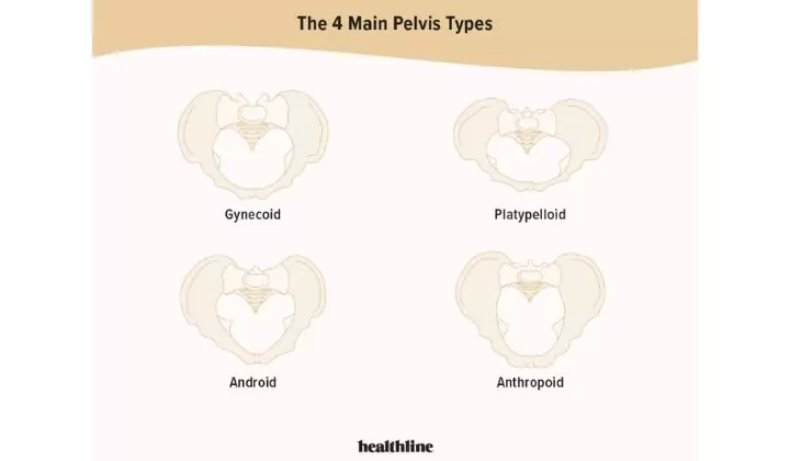Bentuk Pelvis Wanita: Faktor Penting Yang Menentukan Bersalin Normal Atau Czer 6 Bentuk Pelvis Wanita: Faktor Penting Yang Menentukan Bersalin Normal Atau Czer