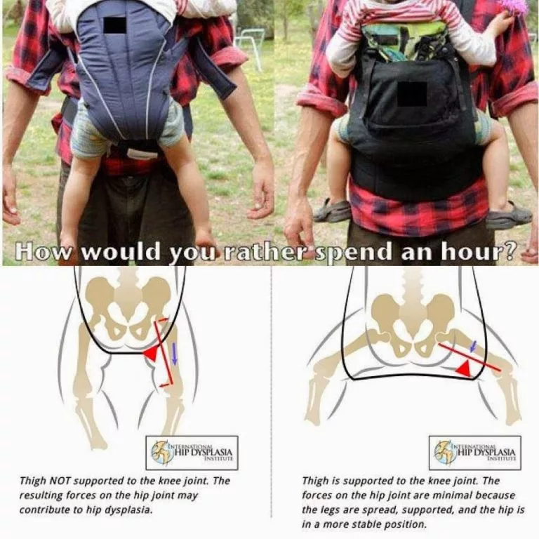 Cara Guna Baby Carrier Dengan Betul: Elak Risiko Kecederaan Pinggul Bayi