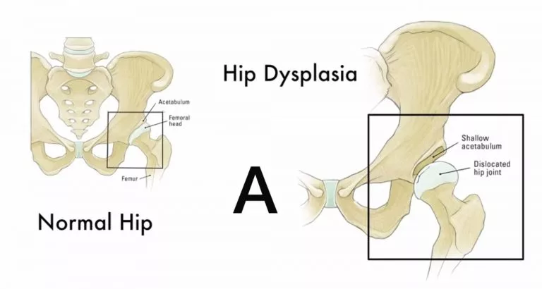 Cara Guna Baby Carrier Dengan Betul: Elak Risiko Kecederaan Pinggul Bayi