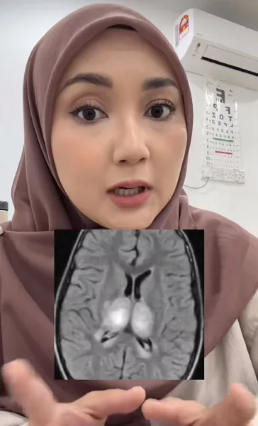 Bahaya NSAIDs Untuk Anak Demam Influenza, Doktor Jelaskan Risiko Sebenar!