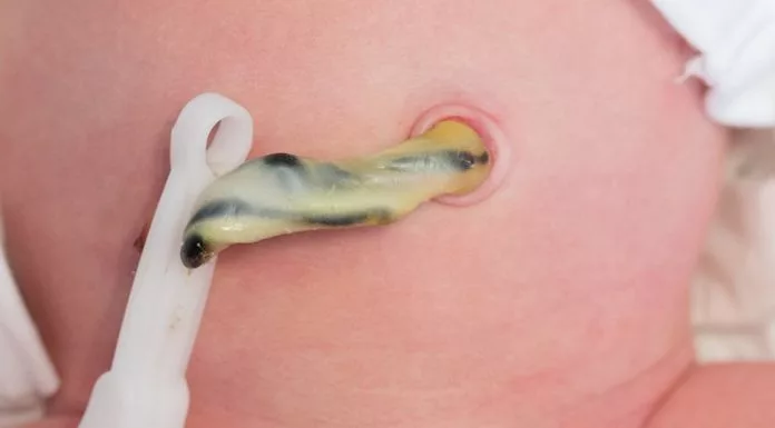 Penjagaan Tali Pusat Bayi, Cara Betul, Bersih & Selamat Tanpa Panik