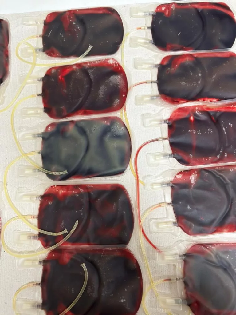 Kanak-Kanak Kanser Perlukan 5 Beg Sehari – Pusat Darah Negara