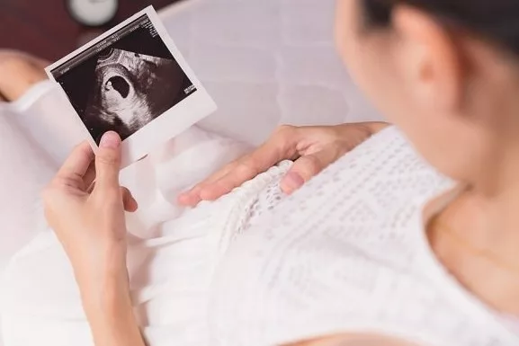 Kehamilan Anggur: Info Penting Yang Wajib Diketahui Semua Ibu & Pasangan Baru