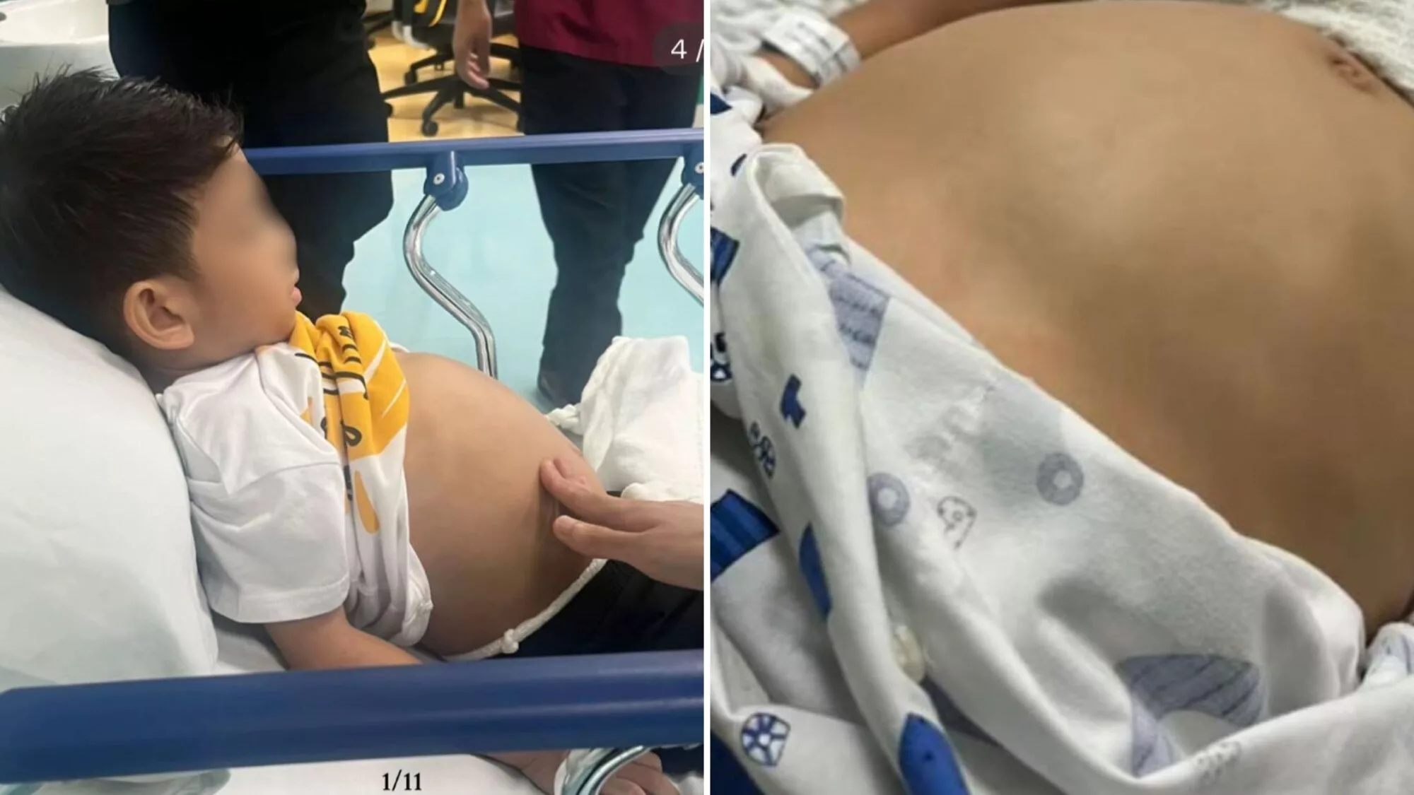 Intoleransi Gluten: Ibu Terkejut, Anak Tiba-Tiba Sakit Lepas Makan Roti, Perut Kembung & Bengkak