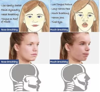 Anak Tidur Ternganga Setiap Malam? Bahaya Tersembunyi & Kesan Mengejutkan Pada Perkembangan Anak 10 Anak Tidur Ternganga Setiap Malam? Bahaya Tersembunyi & Kesan Mengejutkan Pada Perkembangan Anak