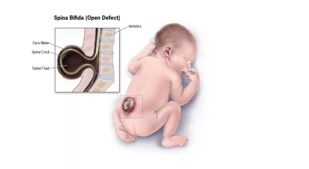 Bahaya Kekurangan Asid Folik: Risiko Serius Buat Ibu Hamil & Bayi