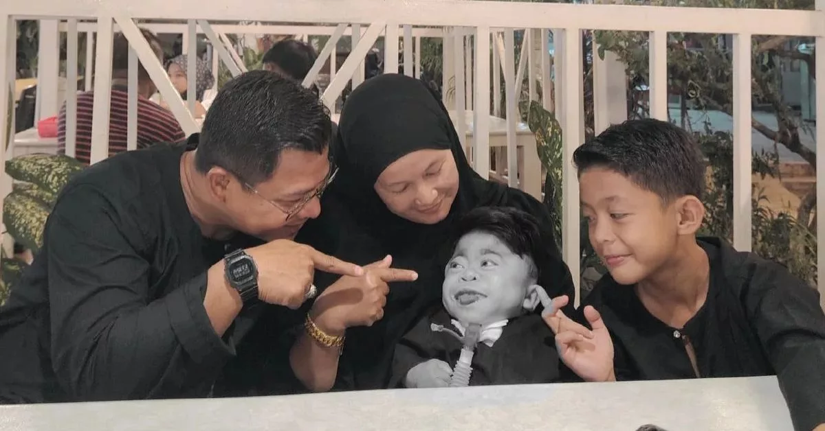 Mucolipidosis Tahap Dua: Kisah Rizki, Anak Syurga Yang Pergi Dalam Dakapan Ibu