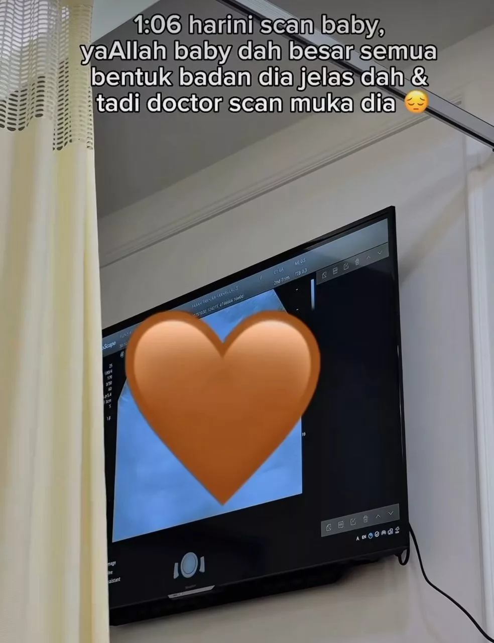 “Rasa Macam Mimpi… Baru Pagi Tadi Scan Baby, Malam Suami Pergi Selamanya”  Kisah Duka Farah Fakhira Kehilangan Suami Tercinta