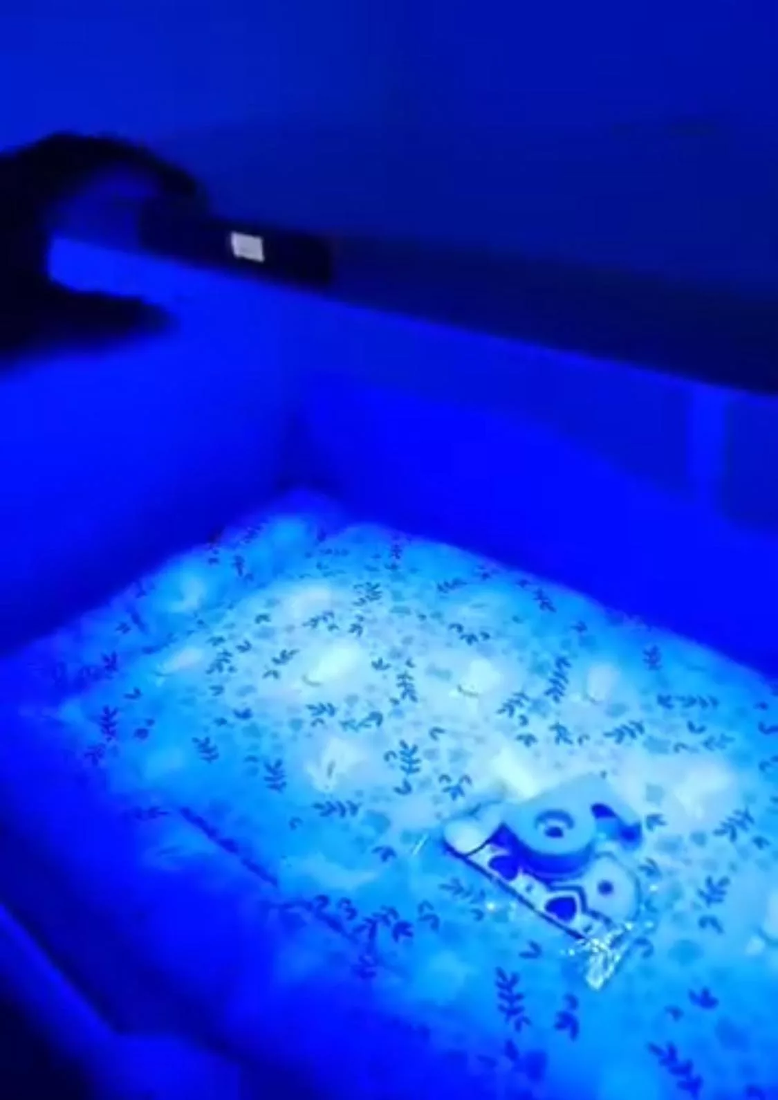 Fototerapi Di Rumah: Risiko Bahaya Kepada Bayi Yang Ramai Tak Sedar