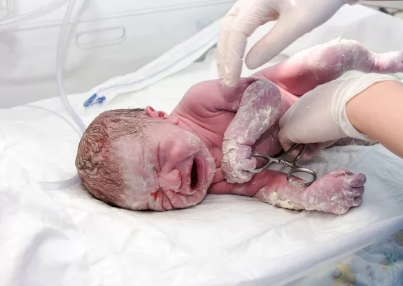 Yang Putih Pada Badan Bayi Baru Lahir Bukan Air Mani , Ini Fungsi Vernix Caseosa