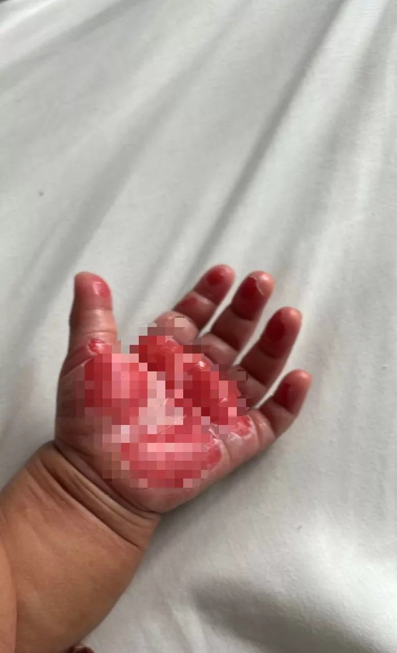 Bahaya Besi Panas: Kisah Menyentuh Hati Yang Jadi Amaran Penting Untuk Ibu Bapa 5 Bahaya Besi Panas: Kisah Menyentuh Hati Yang Jadi Amaran Penting Untuk Ibu Bapa