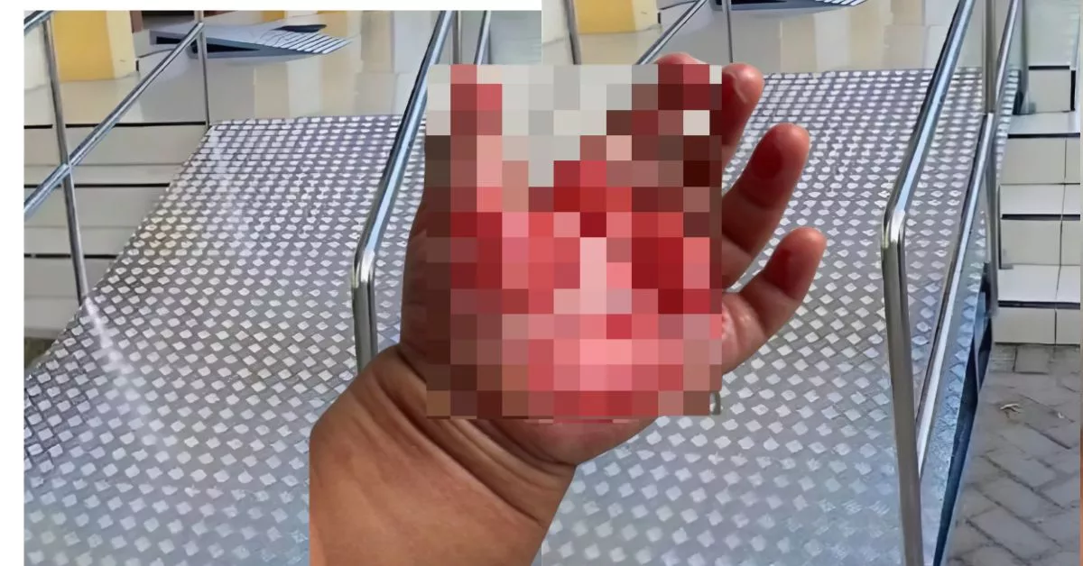 Bahaya Besi Panas: Kisah Menyentuh Hati Yang Jadi Amaran Penting Untuk Ibu Bapa 17 Bahaya Besi Panas: Kisah Menyentuh Hati Yang Jadi Amaran Penting Untuk Ibu Bapa